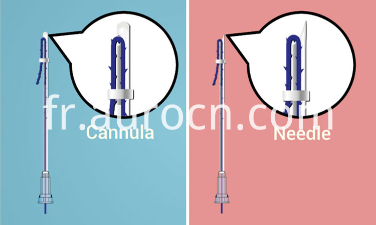 Ascenseur de fil AOP PDO Thread Lift